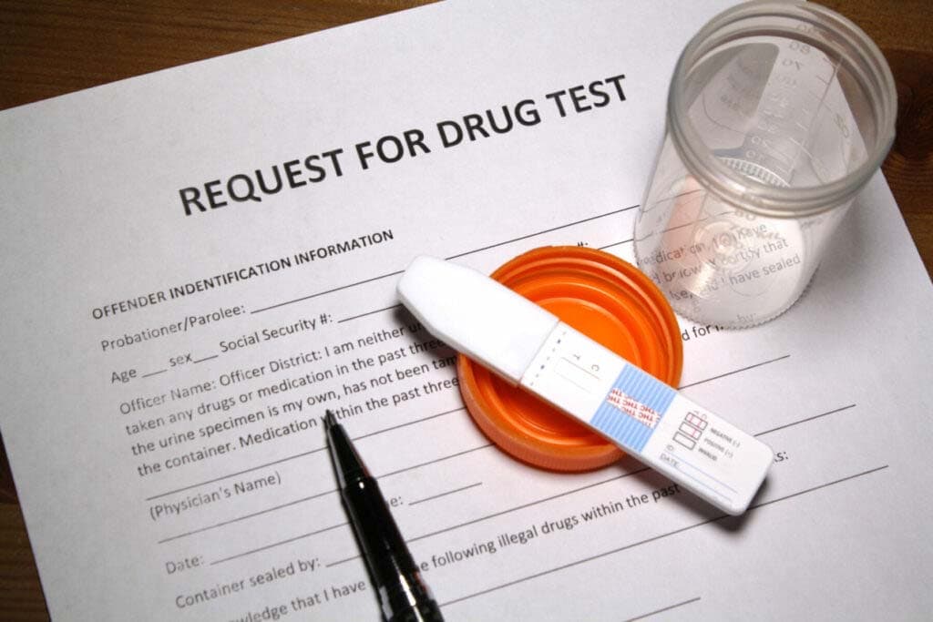 Test kit image presenting DataField Technology Services, emphasizing Drug Testing, seamlessly aligned with the page's context.